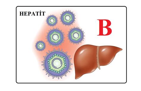 D­i­k­k­a­t­!­ ­H­e­p­a­t­i­t­ ­B­ ­o­l­a­b­i­l­i­r­s­i­n­i­z­ ­-­ ­S­a­ğ­l­ı­k­ ­H­a­b­e­r­l­e­r­i­